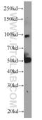 Very long-chain specific acyl-CoA dehydrogenase, mitochondrial antibody, 14527-1-AP, Proteintech Group, Western Blot image 