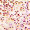 Histone H2B antibody, LS-C356094, Lifespan Biosciences, Immunohistochemistry paraffin image 