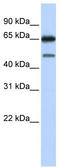 Nuclear Receptor Subfamily 2 Group C Member 2 antibody, TA338235, Origene, Western Blot image 