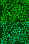 Atrial natriuretic peptide receptor 3 antibody, 23-425, ProSci, Immunofluorescence image 
