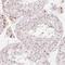 Rho GTPase-activating protein 22 antibody, HPA064439, Atlas Antibodies, Immunohistochemistry frozen image 
