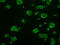ATP Synthase F1 Subunit Beta antibody, M32270, Boster Biological Technology, Immunofluorescence image 