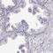 VGF Nerve Growth Factor Inducible antibody, NBP2-56358, Novus Biologicals, Immunohistochemistry paraffin image 