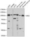 Melanotransferrin antibody, A12988, Boster Biological Technology, Western Blot image 