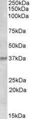 GTP cyclohydrolase I antibody, NBP1-20923, Novus Biologicals, Western Blot image 