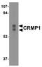 Dihydropyrimidinase-related protein 1 antibody, NBP1-76652, Novus Biologicals, Western Blot image 