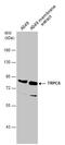 Transient Receptor Potential Cation Channel Subfamily C Member 6 antibody, GTX104730, GeneTex, Western Blot image 