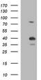 Uracil Phosphoribosyltransferase Homolog antibody, M09616-1, Boster Biological Technology, Western Blot image 