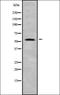 Alkaline Phosphatase, Germ Cell antibody, orb337829, Biorbyt, Western Blot image 