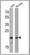Caveolin 1 antibody, MA3-600, Invitrogen Antibodies, Western Blot image 
