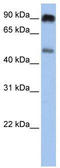 Solute Carrier Family 45 Member 2 antibody, TA334143, Origene, Western Blot image 
