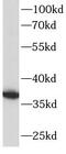 MCL1 Apoptosis Regulator, BCL2 Family Member antibody, FNab05053, FineTest, Western Blot image 