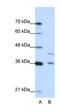 Fragile X mental retardation protein 1 homolog antibody, orb330126, Biorbyt, Western Blot image 