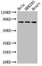 Complement C1r subcomponent antibody, CSB-PA003655LA01HU, Cusabio, Western Blot image 