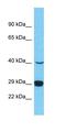 Probable inactive serine protease 37 antibody, orb327090, Biorbyt, Western Blot image 