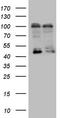 Leucine Rich Repeat Containing G Protein-Coupled Receptor 5 antibody, TA890013S, Origene, Western Blot image 