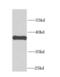 Calcium Homeostasis Modulator 1 antibody, FNab01200, FineTest, Western Blot image 
