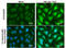 ERCC Excision Repair 2, TFIIH Core Complex Helicase Subunit antibody, GTX105357, GeneTex, Immunofluorescence image 