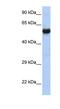 Cholinergic Receptor Nicotinic Gamma Subunit antibody, NBP1-79952, Novus Biologicals, Western Blot image 