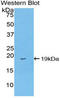 Fatty Acid Binding Protein 2 antibody, LS-C301334, Lifespan Biosciences, Western Blot image 