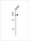 Adenine Phosphoribosyltransferase antibody, LS-C156439, Lifespan Biosciences, Western Blot image 