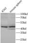 Absent In Melanoma 2 antibody, FNab00238, FineTest, Western Blot image 