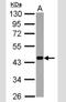 DNA dC->dU-editing enzyme APOBEC-3G antibody, NBP2-53089, Novus Biologicals, Western Blot image 