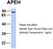 Acylaminoacyl-Peptide Hydrolase antibody, TA346557, Origene, Western Blot image 