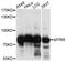 5-Methyltetrahydrofolate-Homocysteine Methyltransferase Reductase antibody, A1462, ABclonal Technology, Western Blot image 