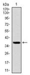 Forkhead Box O1 antibody, AM06731PU-N, Origene, Western Blot image 