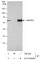 Sequestosome 1 antibody, GTX100685, GeneTex, Immunoprecipitation image 
