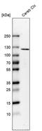 Extracellular Leucine Rich Repeat And Fibronectin Type III Domain Containing 2 antibody, PA5-51454, Invitrogen Antibodies, Western Blot image 