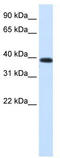 Jumonji Domain Containing 6, Arginine Demethylase And Lysine Hydroxylase antibody, TA329407, Origene, Western Blot image 