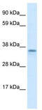 Zinc Finger C2HC-Type Containing 1A antibody, TA331140, Origene, Western Blot image 