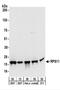 Ribosomal Protein S11 antibody, NBP2-22288, Novus Biologicals, Western Blot image 