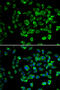 Proteasome 26S Subunit, Non-ATPase 13 antibody, 14-453, ProSci, Immunofluorescence image 