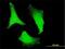 Ribosomal Protein S2 antibody, H00006187-M01, Novus Biologicals, Immunofluorescence image 