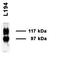 Solute Carrier Family 14 Member 2 antibody, orb67570, Biorbyt, Western Blot image 