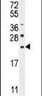 C-Type Lectin Domain Family 2 Member L antibody, PA5-24394, Invitrogen Antibodies, Western Blot image 
