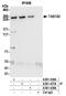 Tankyrase 1 Binding Protein 1 antibody, A301-439A, Bethyl Labs, Immunoprecipitation image 