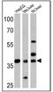 Forkhead Box A3 antibody, PA1-813, Invitrogen Antibodies, Western Blot image 