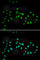 DNA Methyltransferase 3 Alpha antibody, A3169, ABclonal Technology, Immunofluorescence image 