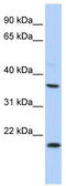 Potassium Calcium-Activated Channel Subfamily M Regulatory Beta Subunit 3 antibody, TA338746, Origene, Western Blot image 