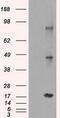 Cancer/testis antigen 1 antibody, GTX84652, GeneTex, Western Blot image 