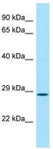 Craniofacial Development Protein 1 antibody, TA340097, Origene, Western Blot image 