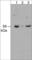 Proto-oncogene tyrosine-protein kinase Yes antibody, YM2501, ECM Biosciences, Western Blot image 