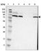 Coiled-Coil Domain Containing 186 antibody, NBP1-90441, Novus Biologicals, Western Blot image 