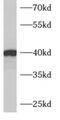 Armadillo Repeat Containing X-Linked 3 antibody, FNab00590, FineTest, Western Blot image 