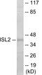 ISL LIM Homeobox 2 antibody, EKC1896, Boster Biological Technology, Western Blot image 