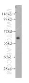 NUMB Endocytic Adaptor Protein antibody, 11876-1-AP, Proteintech Group, Western Blot image 